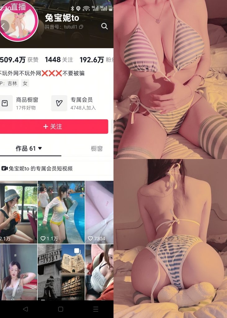 图片[1]-【抖音反差】兔宝妮to-条纹内衣套件[16P]-蜜桃啵啵